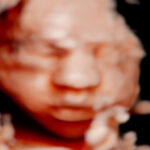 Imagen de bebé de 29 semanas de gestacion con ecografía 5D.